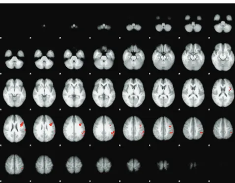 FIG 4. Hypothesis-driven GLM analysis for contrast of APPREHENSION videos vs CONTROL videos