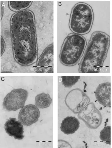 Figure 2. Effect of caprylic acid on the ultrastructure of E. coli CCM 3954 (A, C) and CCM 4225 (B, D) as demos-trated by transmission electron microscopy