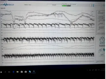 Fig. 5. Recorded EEG signals 