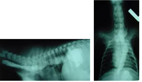 Figure 2. Preoperative radiographs (left, lateral and right, ventrodorsal) after surgical correction revealed an almost normal oesophagus except for a little dilatation