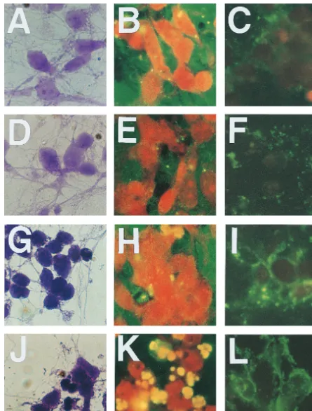 FIG. 7. Morphological changes and induction of apoptosis in primary cultured neurons infected with CVS-N2c (A to F) or CVS-B2c (G to L) virus