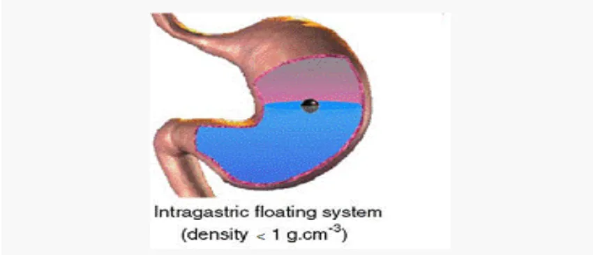 Fig: 5 Graphic of the buoyant tablet which is less dense than the stomach fluid and 