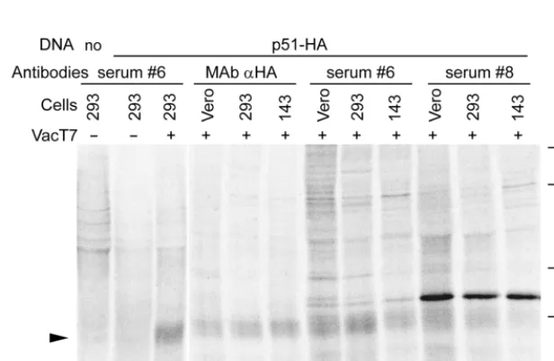 FIG. 1. (A) Hydrophobicity proﬁle of U51 (Kyte-Doolittle) and localizationof peptides 1 and 2, employed as antigens to derive immune sera 8 and 6,