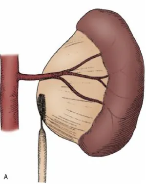 Figure 1 - PUJO