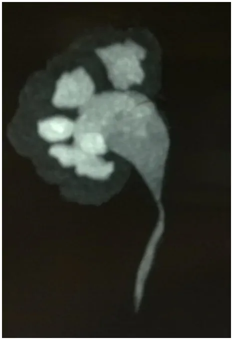 Figure 5 - Reconstructed Image of Rt PUJO
