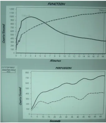 Figure 6 - Time Intensity Curve – Lt PUJO