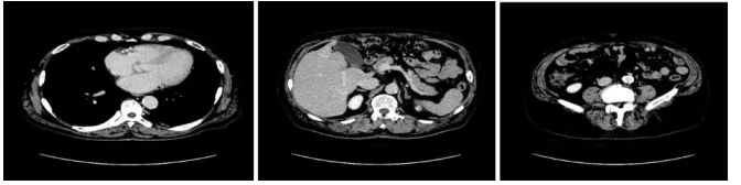 Fig. 3. Sample slices from the first CT dataset. 