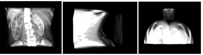 Fig. 9. Same 3D object, 0.03 opacity, no clipping, front facing, (center) rotated 90 degrees on the Y-axis and (right) rotated 90 degrees on X-axis
