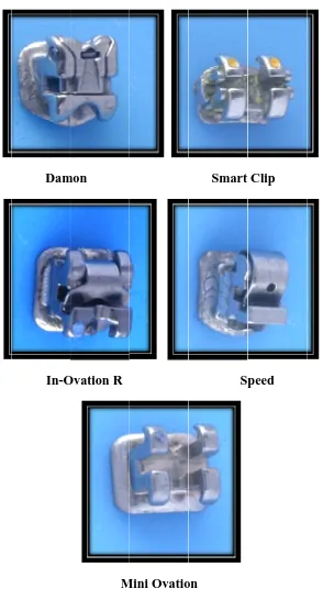 Figuree 1 : Brackkets used inn the study
