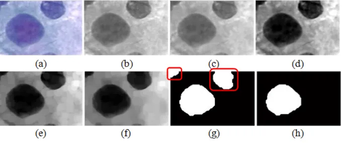 Fig. 2. (b) grayscale image (c) median filtering (d) contrast stretching (e) opening Nucleus segmentation processes (a) original image (f) opening and closing (g) thresholding (h) clearing 