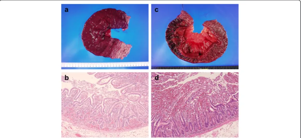Figure 1 Macro- and microscopic findings of grades 1 and 2. a The mucosa of grade 1 shows a segmental color change to deep red.b The mucosal injury of grade 1 shows mild mucosal degeneration with extended subepithelial space (H & E stain, ×10)