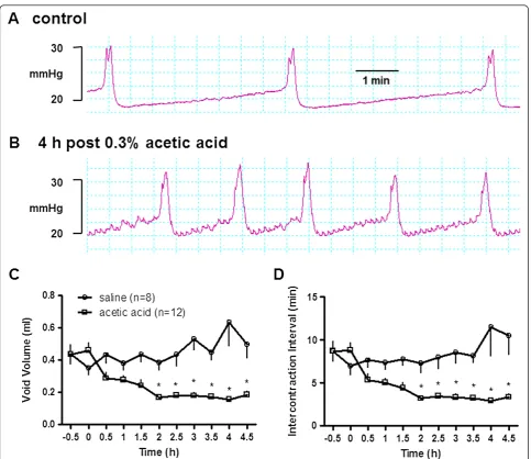 Figure 1 The urodynamic response to intravesical administration of 0.3% acetic acid. A and B