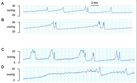 Table 2 Changes in cystometry parameters to spinal nerve stimulation for 1 hr