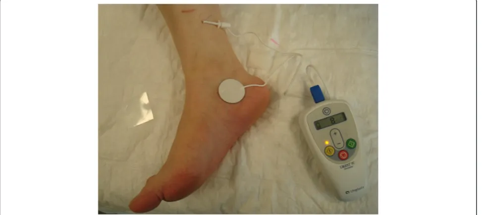 Figure 1 Stimulator and technique for percutaneous tibial nerve stimulation (PTNS).