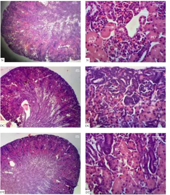 Figure 4. The  histological representation of  the  neo-nates’ kidneys collected from the  normal (N), diabetic control (DC) and diabetic treated (DT) dams at the end of the  trial (90  days)