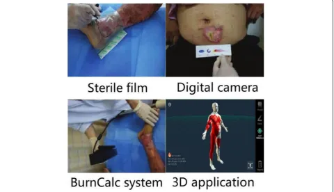 Fig. 1 Current mainstream diagnostic methods of burn wounds