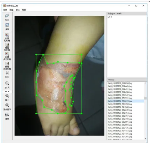 Fig. 2 Annotation tool. With the help of professional doctors, we use the corresponding annotation tool to annotate the image data