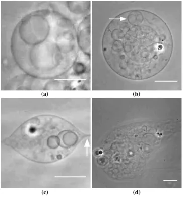 Fig. 3  Photomicrographs to show the four varieties of MVL identified. Type 1b. An internal liposome containing recursive liposomes is arrowed