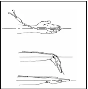 Figure 3.5: Goniometry Attachment for            Figure 3.6: Goniometry Attachment for two-axis and single-axis sensors 