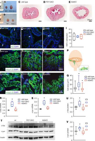 Figure 6. P2Y12(wild-type ( and A2b signaling modulate bladder smooth muscle cell growth differentially through immediate early genes, c-fos and c-jun