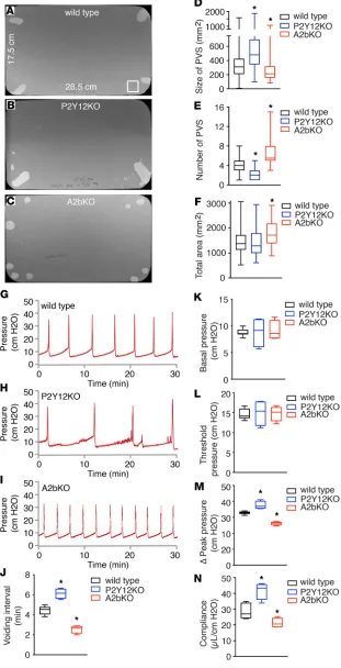 Figure 3. Deletion of P2Yaltered in vivotative images of voiding spot assay (VSA) filter papers from wild-type (12 or A2b receptor results in  bladder function