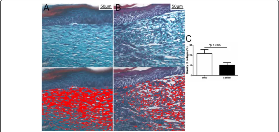 Fig. 7 Measurement of the thickness of the newly generated epidermis in the healed wounds in the a TWD group and b control group.c Application of the TWD significantly increased the thickness of the newly generated epidermis