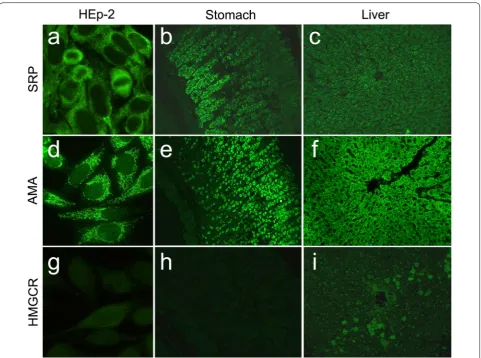 Fig. 2 Immunofluorescence patterns from patients with IMNMs with anti-SRP and anti-HMGCR antibodies on HEp-2 ANA slides (EUROIMMUN, Lübeck, Germany) and rat liver and stomach slides (DiaSorin, Italy), compared to AMA-M2 antibodies