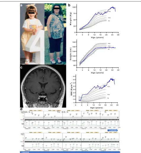 Fig. 1 a Photograph of the patient at age 4 (left) compared to 26 (right). b Coronal view of brain MRI with no abnormality detected c Growthcharts constructed with standard data obtained from CDC [20]