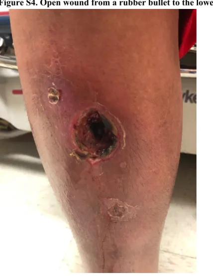 Figure S4. Open wound from a rubber bullet to the lower extremity.  