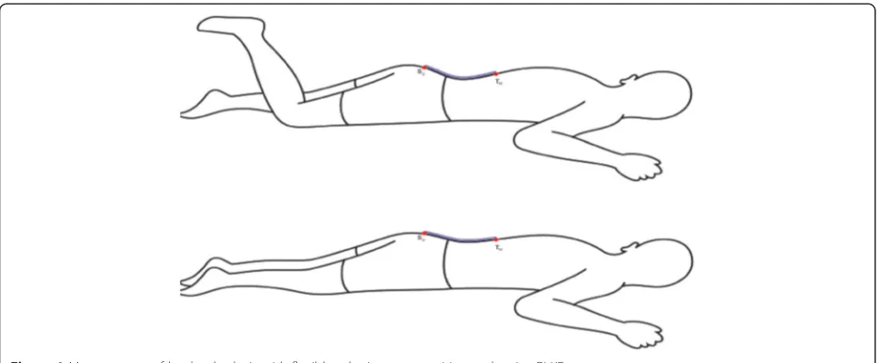 Figure 1 Measurement of lumbar lordosis with flexible ruler in prone position and active PLKF.