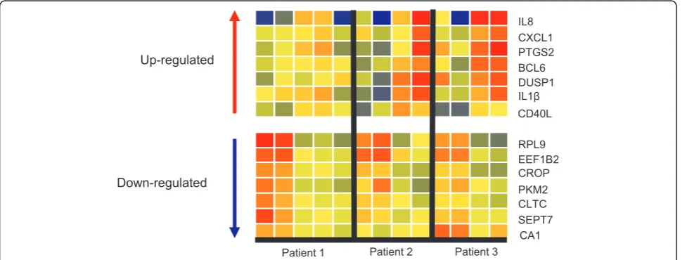 Figure 2 Heat maps of differentially expressed transcripts (visualize up and down-regulated transcriptspatient) versus 7 and 16 week timepoints (columns 3 and 4 for each patient)
