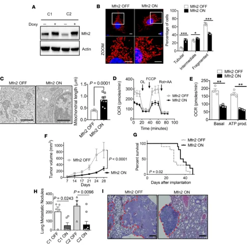 Figure 3. Direct induction of mitochondrial fusion by Mfn2 overexpression suppresses pancreatic cancer growth