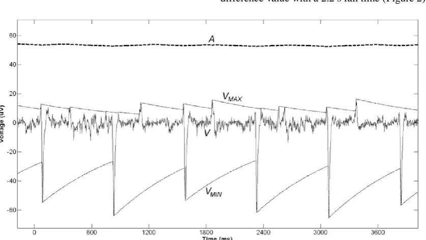 Figure 2  ECG signal V, positive VMAX and negative VMIN envelopes and the resulting amplitude A 