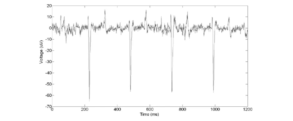Figure  3  The raw ECG input VNEW and the tracked baseline B. 