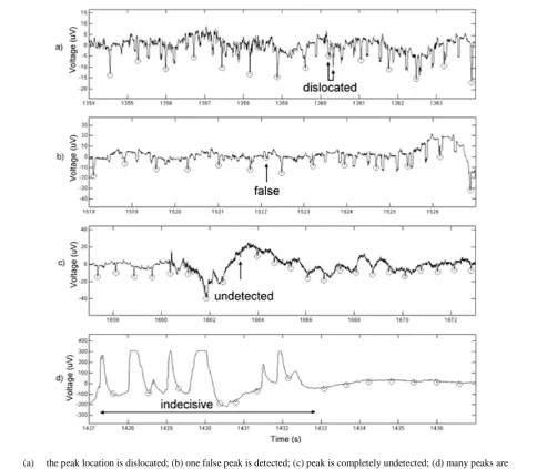 Figure 5 Detector error classification 