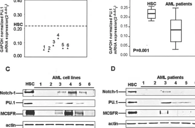 Figure 2. Down-regulation of Notch-1 expression decreased the PU.1-mediated myeloid differentiation signaling in AML