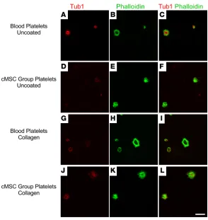 Figure 6. Generated platelets are able to spread on glass and matrix proteins. (A–F) Platelets generated from cMSC cultures were positively stained with immunofluorescence for β1 tubulin and phalloidin (A–C), similar to native plate-lets from peripheral bl