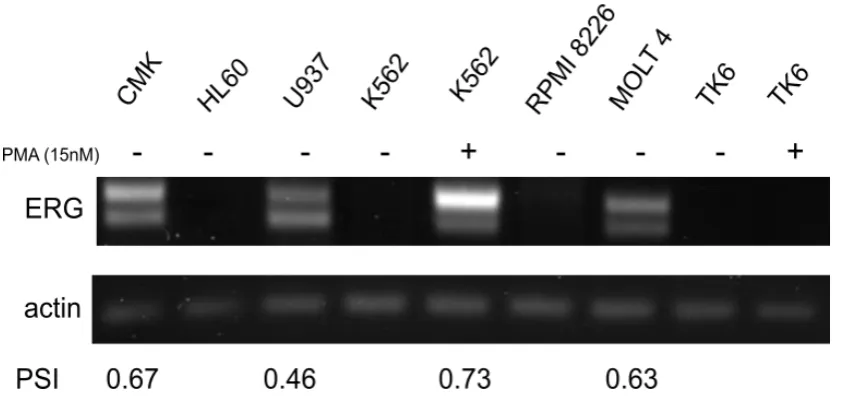 Figure 3.9 ERG exon 7b expression in haematological cell lines 