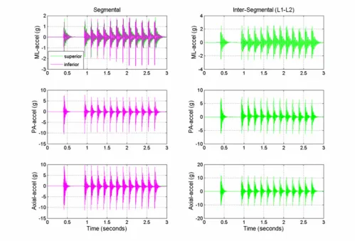 Figure 2setting at T12 spinous process, 13 pulse trains)Typical segmental (L1, superior and L2, inferior) and intersegmental (L1–L2) medial-lateral (ML), posterior-anterior (PA), and axial acceleration responses (m/s) during the application of haversine-like mechanical excitation to the ovine spine (high force Typical segmental (L1, superior and L2, inferior) and intersegmental (L1–L2) medial-lateral (ML), posterior-anterior (PA), and axial acceleration responses (m/s2) during the application of haversine-like mechanical excitation to the ovine spine (high force 