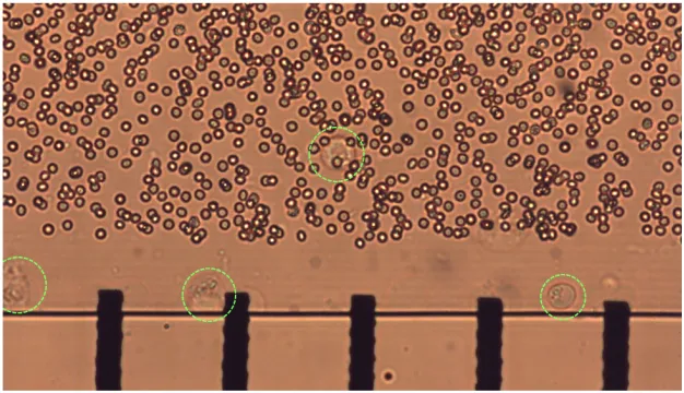 Fig. 2. Separation process of abnormal cells within the microfluidic flow.  