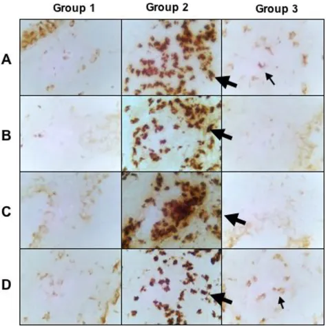 Figure 5latex challenged treated with curcumin (Group 3)Immunohistochemical staining for IL-4, IL-5, IL-13, and IFN-γ of control mice (Group 1), latex challenged mice (Group 2), and Immunohistochemical staining for IL-4, IL-5, IL-13, and IFN-γ of control m