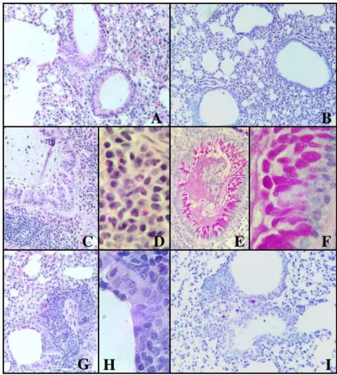 Figure 4Histology of the lungs studied from control and experimental miceHistology of the lungs studied from control and experimental mice