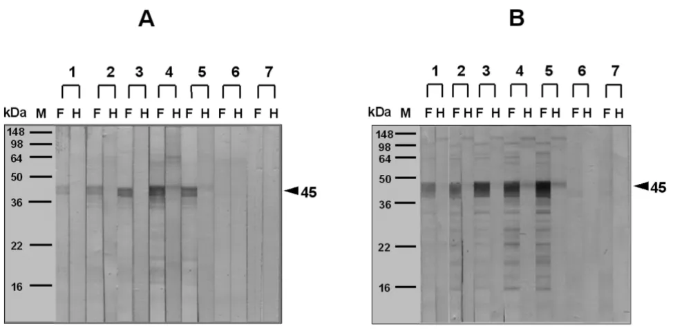 Figure 4Effect of boiling on wild-type (A) and GM (B) potato allergenicity, analyzed by IgE-immunoblottingEffect of boiling on wild-type (A) and GM (B) potato allergenicity, analyzed by IgE-immunoblotting