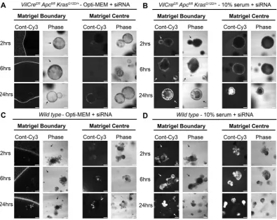 Figure 3. Primary organoid uptake of siRNA is more efficient when complexes are formed with serum