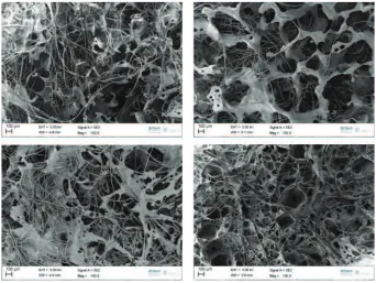 Figure 2.8: Scanning electron microscopy images of PdlLA sponges with SF ﬁbers.The concentration of the initial polymer solution is diﬀerent as the amount of theSF ﬁbers.