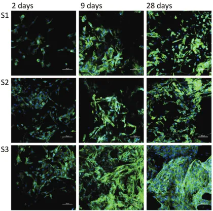 Figure 4.4: Confocal Laser Scanning Microscopy images of MG63 cells stained withDapi and Oregon Green 488 Phalloidin