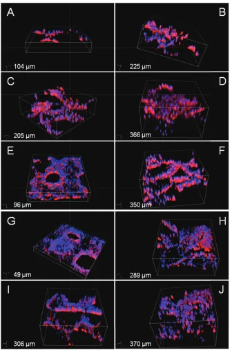 Figure 3.5: 3D Confocal Laser Scanning Microscopy images of MG63 cells stainedwith Rhodamine Phalloidin and DAPI adhered to PdlLA scaﬀolds after A, B) 4days, C, D) 7 days, E, F) 14 days, G, H) 21 days, and J, K) 28 days of cell culture.On the left the microfabricated scaﬀolds, on the right the salt-leached sponges.Stack depths are speciﬁed.
