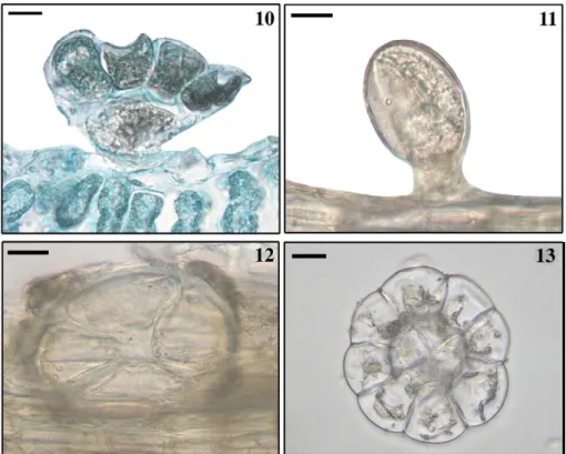 Fig. 10 –13. Light micrographs of Type A peltate glandular trichomes of Salvia chrysophylla on the: (10) leaf abaxial surface, (11) stem, (12) inflorescence axis, and (13) calyx