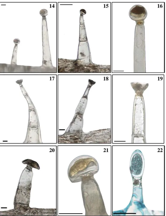 Fig. 14 –22. Light micrographs of Type B capitate glandular trichomes of Salvia chrysophylla: (14) Type B1 on the stem, (15–16) Type B1 on the inflorescence axis, (17 –19) Type B2 on the inflorescence axis, (20–21) Type B3 on the calyx, and (22) Type B4 ca