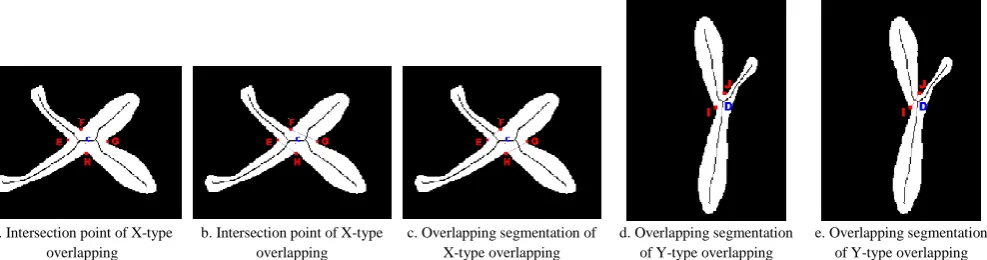 Figure 9  Extraction of the intersection and overlapping segmentation  